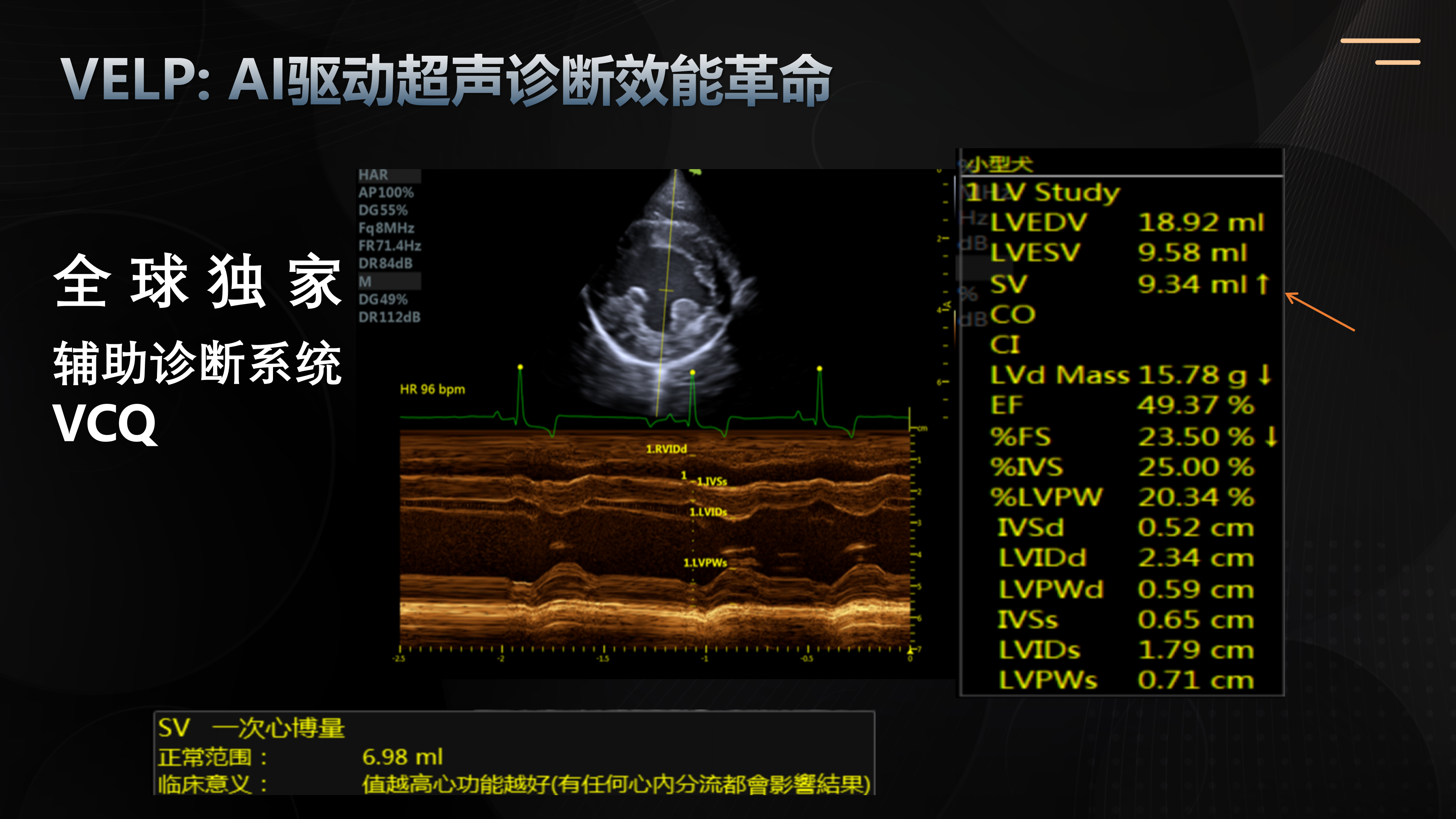 VCQ 辅助诊断系统